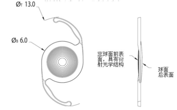 愛爾康三焦點